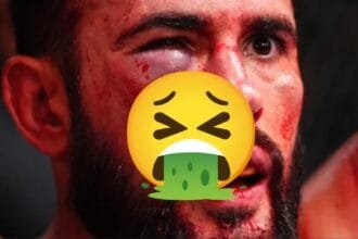 Dana White Shows Off UFC Fighter's Horrifying Lip Injury